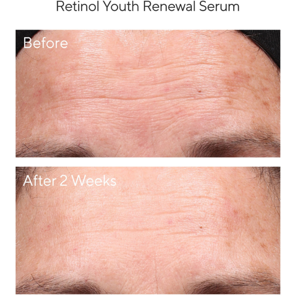 Retinol Youth Renewal Serum, 30ml