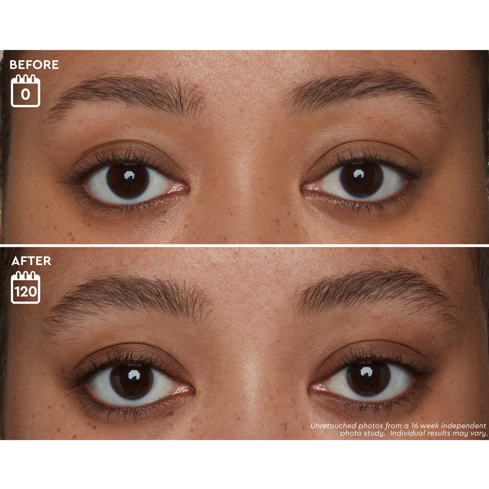 Brow Genius® Serum