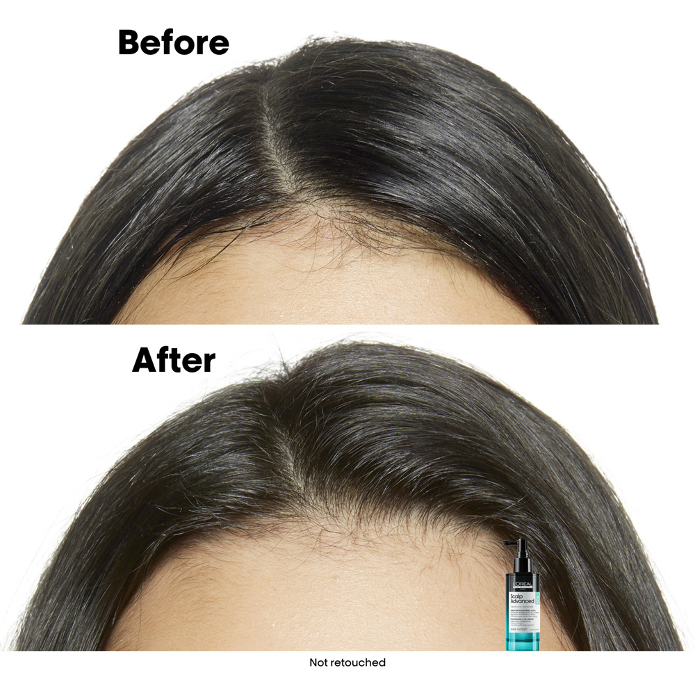 Scalp Advanced Anti-Oiliness Shampoo, 300ml