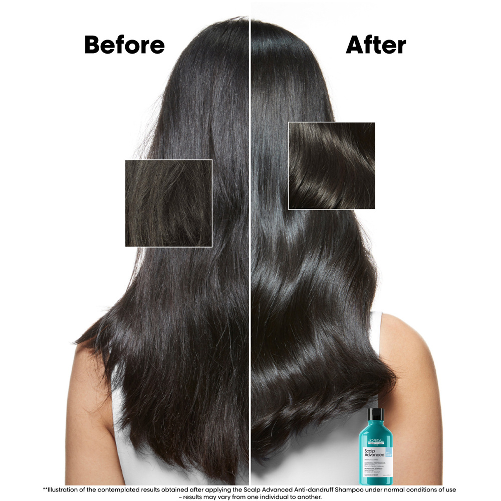 Scalp Advanced Anti-Dandruff Shampoo, 300ml