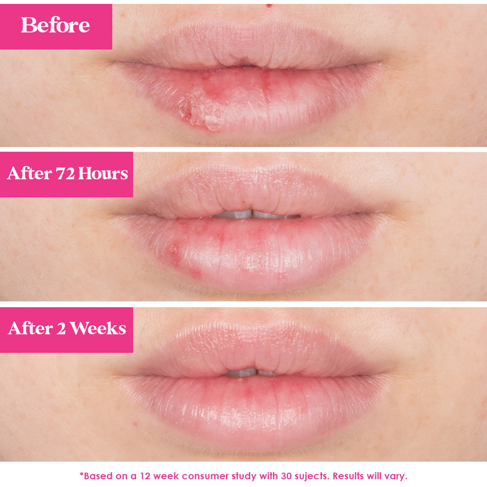 GrandePOUT Plumping Lip Mask