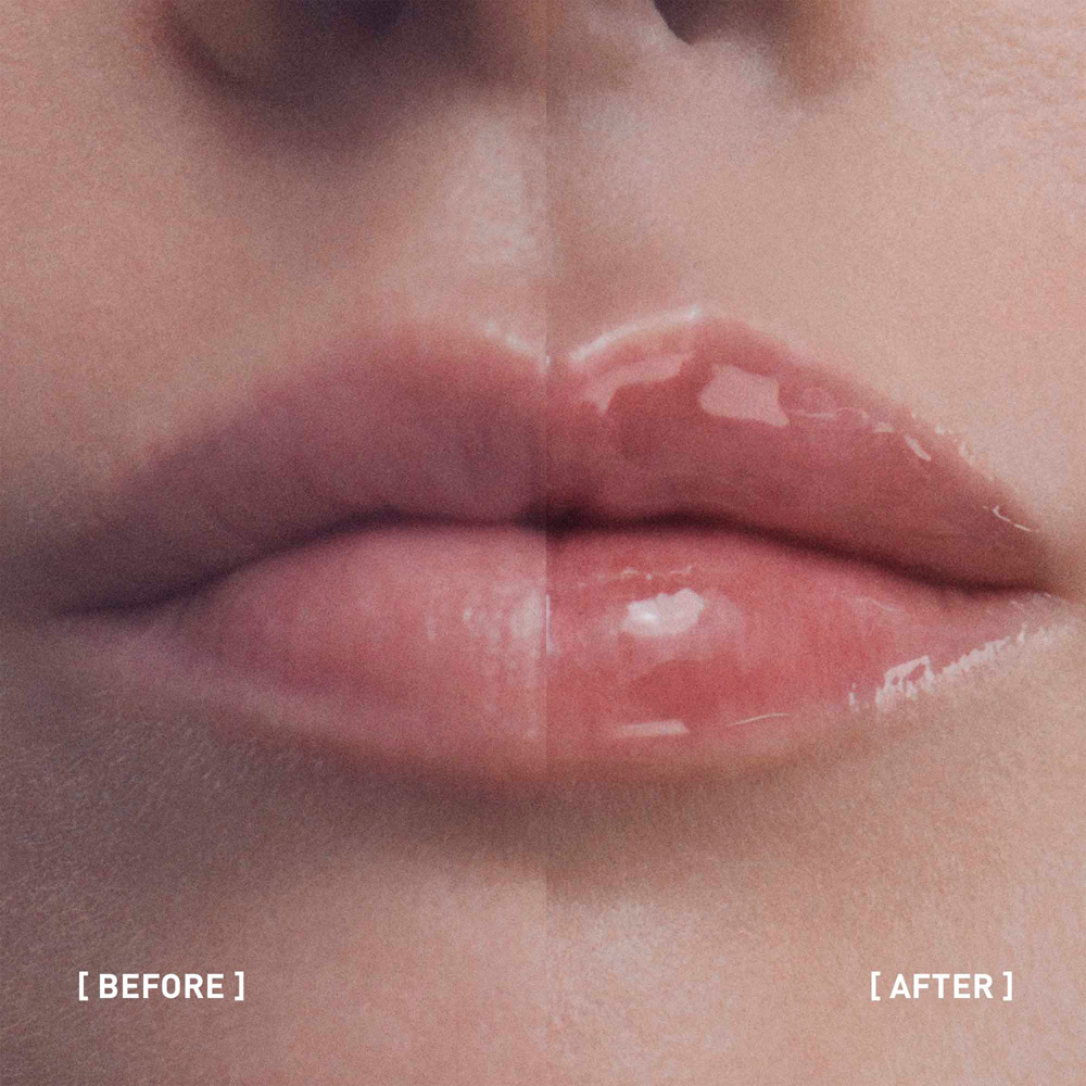 Hyalu-Filler Lips, 4g