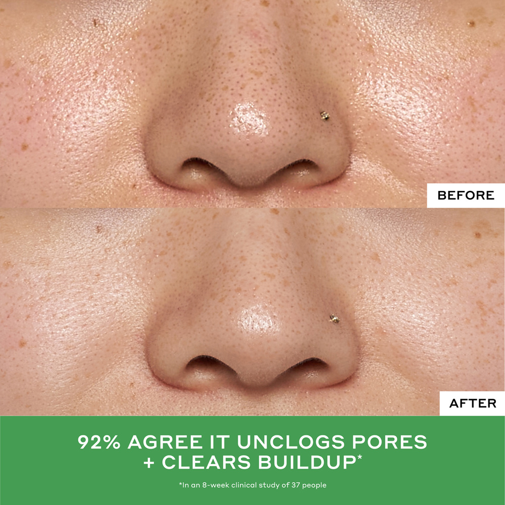 Balance Detox Drops 2% Salicylic Acid Toner, 120ml