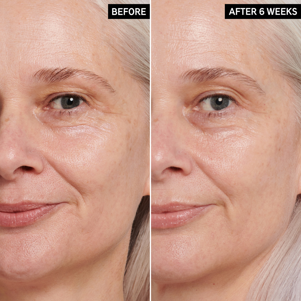 Retinol Eye Cream, 15ml