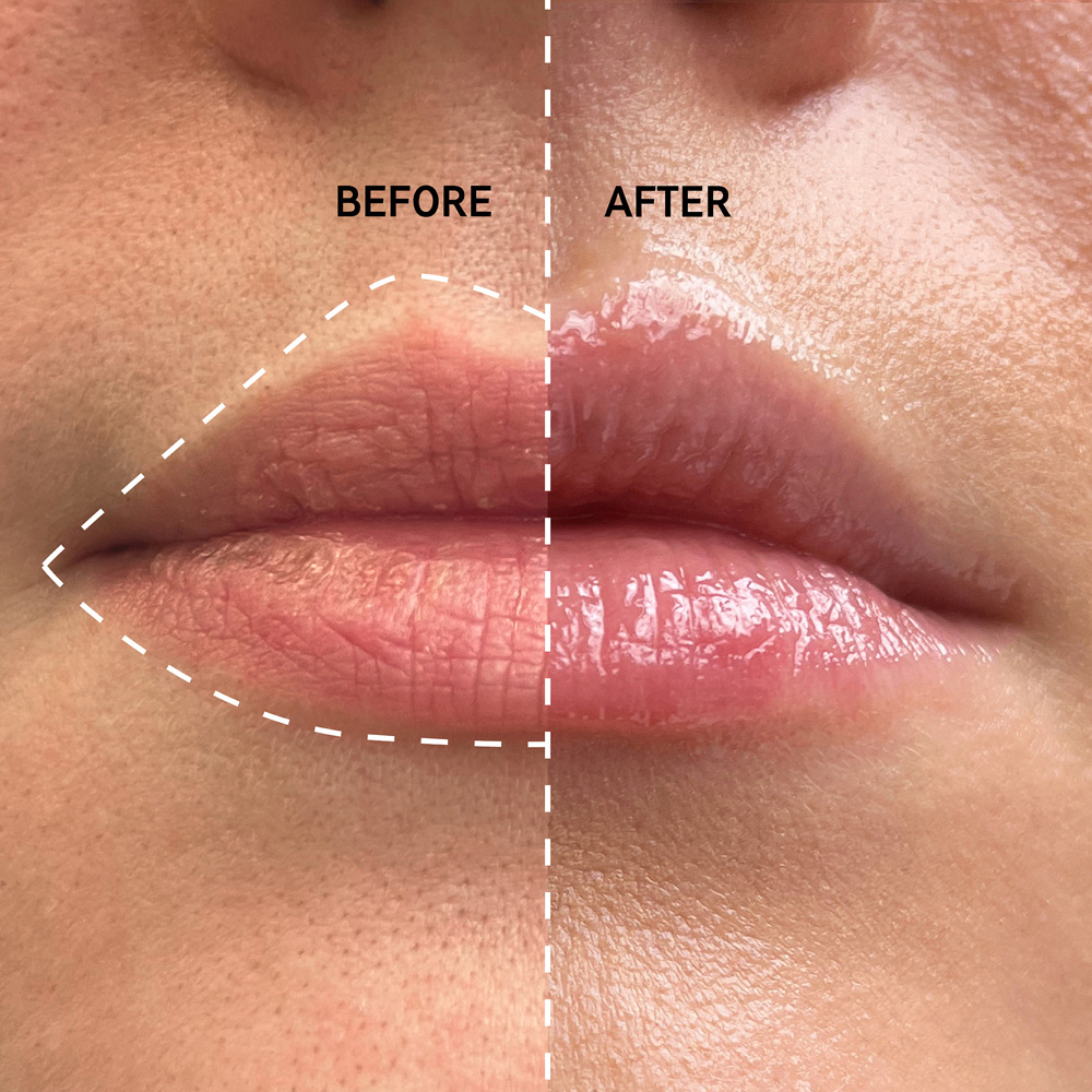 Tripeptide Plumping Lip Balm, 10ml