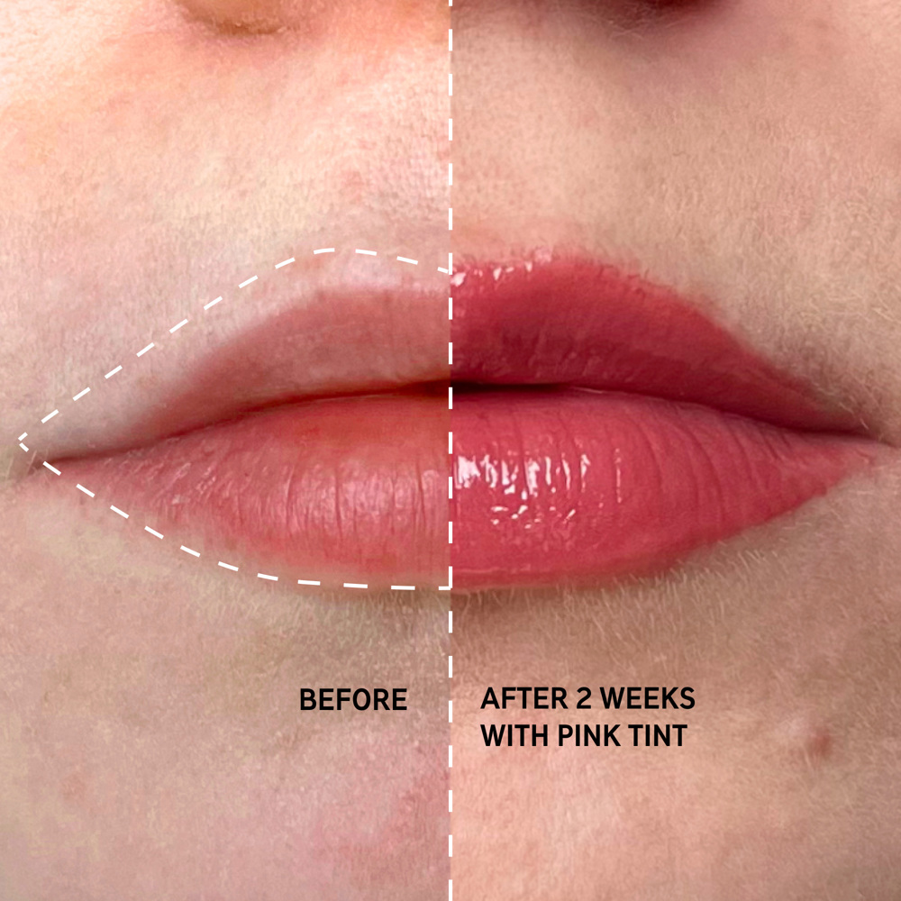 Tripeptide Plumping Lip Balm, 10ml