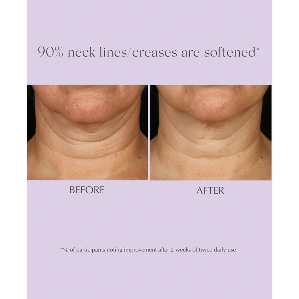 Age Reverse Advanced Toning Neck Cream, 125g