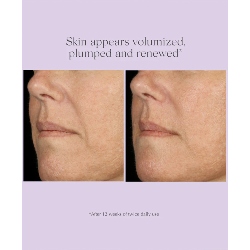 Age Reverse Advanced Total Correct Serum, 30ml