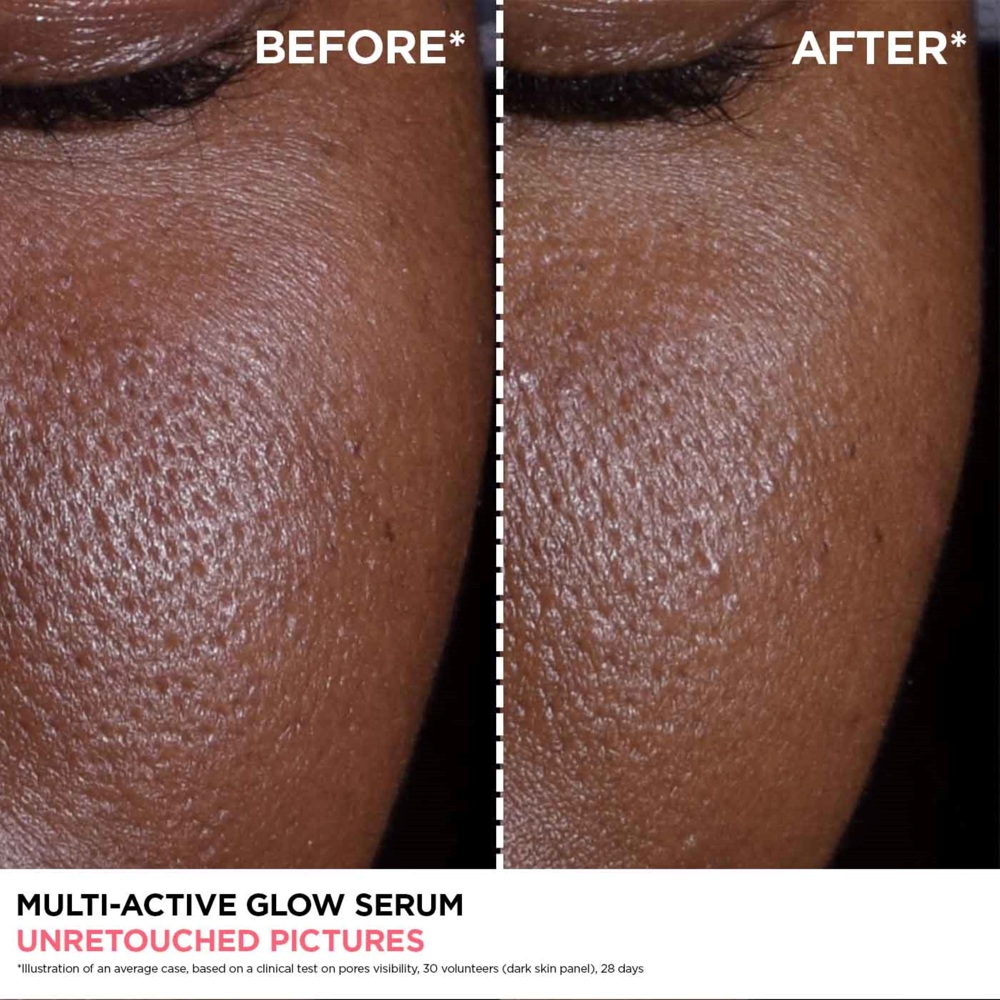 Multi-Active Glow Serum, Skin Refining, Texture Smoothing, 30ml